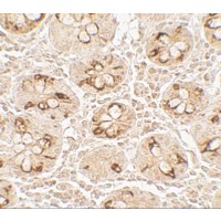 TMIGD2 Antibody - Immunohistochemistry of TMIGD2 in human small intestine tissue with TMIGD2 antibody at 5 µg/mL.
