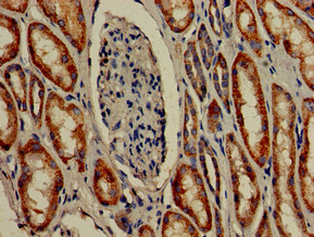 TMIGD2 Antibody - Immunohistochemistry of paraffin-embedded human kidney tissue using TMIGD2 Antibody at dilution of 1:100
