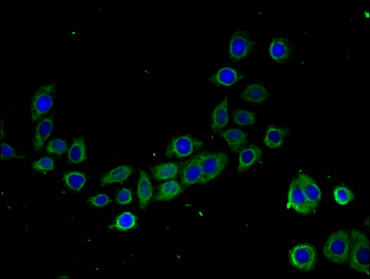 TMIGD2 Antibody - Immunofluorescent analysis of PC3 cells using TMIGD2 Antibody at a dilution of 1:100 and Alexa Fluor 488-congugated AffiniPure Goat Anti-Rabbit IgG(H+L)