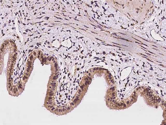 TMIGD2 Antibody - Immunochemical staining of human TMIGD2 in human gallbladder with rabbit polyclonal antibody at 1:100 dilution, formalin-fixed paraffin embedded sections.
