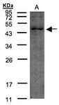 TMLHE / TMID Antibody - Sample (30 ug of whole cell lysate). A: HeLa S3. 12% SDS PAGE. TMLHE antibody diluted at 1:200