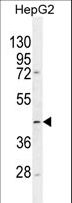 TMLHE / TMID Antibody - TMLHE Antibody western blot of HepG2 cell line lysates (35 ug/lane). The TMLHE antibody detected the TMLHE protein (arrow).