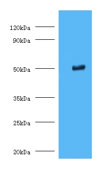 TMLHE / TMID Antibody - Western blot of Trimethyllysine dioxygenase, mitochondrial antibody at 2 ug/ml with MCF-7 whole cell lysate. Secondary: Goat polyclonal Rabbit IgG at 1:1000 dilution. Predicted band size: 50 KDa. Observed band size: 50 KDa.  This image was taken for the unconjugated form of this product. Other forms have not been tested.