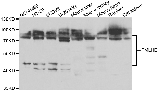 TMLHE / TMID Antibody - Western blot analysis of extracts of various cell lines.