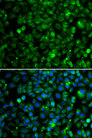 TMLHE / TMID Antibody - Immunofluorescence analysis of MCF7 cells.