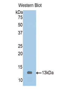 TMOD1 / Tropomodulin 1 Antibody - Western blot of recombinant TMOD1 / Tropomodulin 1.  This image was taken for the unconjugated form of this product. Other forms have not been tested.