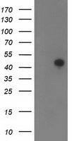 TMOD1 / Tropomodulin 1 Antibody - HEK293T cells were transfected with the pCMV6-ENTRY control (Left lane) or pCMV6-ENTRY TMOD1 (Right lane) cDNA for 48 hrs and lysed. Equivalent amounts of cell lysates (5 ug per lane) were separated by SDS-PAGE and immunoblotted with anti-TMOD1.