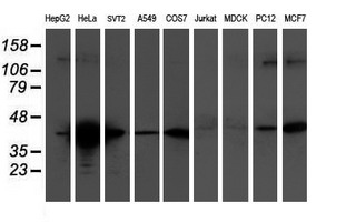 TMOD1 / Tropomodulin 1 Antibody - Western blot of extracts (35 ug) from 9 different cell lines by using anti-TMOD1 monoclonal antibody.