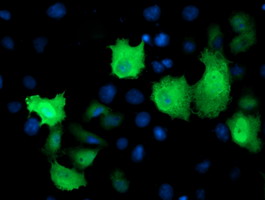 TMOD1 / Tropomodulin 1 Antibody - Anti-TMOD1 mouse monoclonal antibody immunofluorescent staining of COS7 cells transiently transfected by pCMV6-ENTRY TMOD1.