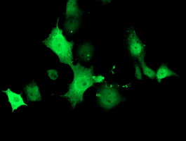 TMOD1 / Tropomodulin 1 Antibody - Anti-TMOD1 mouse monoclonal antibody immunofluorescent staining of COS7 cells transiently transfected by pCMV6-ENTRY TMOD1.