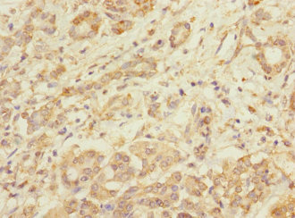 TMOD1 / Tropomodulin 1 Antibody - Immunohistochemistry of paraffin-embedded human pancreatic tissue at dilution 1:100