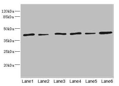 TMOD1 / Tropomodulin 1 Antibody - Western blot All Lanes: TMOD1 antibody at 1.85ug/ml Lane 1: Mouse brain tissue Lane 2: Mouse lung tissue Lane 3: Hela whole cell lysate Lane 4: K562 whole cell lysate Lane 5: A549 whole cell lysate Lane 6: MCF7 whole cell lysate Secondary Goat polyclonal to rabbit IgG at 1/10000 dilution Predicted band size: 41,27 kDa Observed band size: 41 kDa