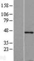 TMOD1 / Tropomodulin 1 Protein - Western validation with an anti-DDK antibody * L: Control HEK293 lysate R: Over-expression lysate