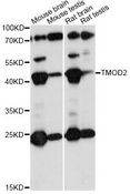 TMOD2 / Tropomodulin 2 Antibody - Western blot analysis of extracts of various cell lines, using TMOD2 antibody at 1:1000 dilution. The secondary antibody used was an HRP Goat Anti-Rabbit IgG (H+L) at 1:10000 dilution. Lysates were loaded 25ug per lane and 3% nonfat dry milk in TBST was used for blocking. An ECL Kit was used for detection and the exposure time was 30s.