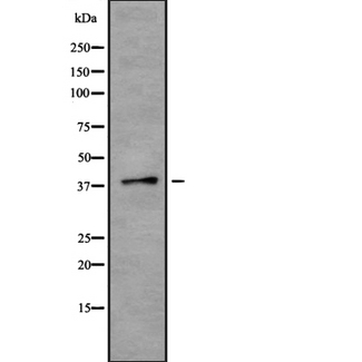 TMOD2 / Tropomodulin 2 Antibody - Western blot analysis of TMOD2 using K562 whole cells lysates