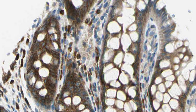 TMOD2 / Tropomodulin 2 Antibody - 1:100 staining rat colon tissue by IHC-P. The sample was formaldehyde fixed and a heat mediated antigen retrieval step in citrate buffer was performed. The sample was then blocked and incubated with the antibody for 1.5 hours at 22°C. An HRP conjugated goat anti-rabbit antibody was used as the secondary.