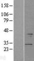 TMOD2 / Tropomodulin 2 Protein - Western validation with an anti-DDK antibody * L: Control HEK293 lysate R: Over-expression lysate