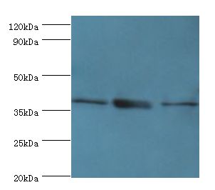 TMOD3 / Tropomodulin 3 Antibody - Western blot. All lanes: TMOD3 antibody at 5 ug/ml. Lane 1: Jurkat whole cell lysate. Lane 2: MCF-7 whole cell lysate. Lane 3: HeLa whole cell lysate. Secondary antibody: Goat polyclonal to rabbit at 1:10000 dilution. Predicted band size: 40 kDa. Observed band size: 40 kDa.