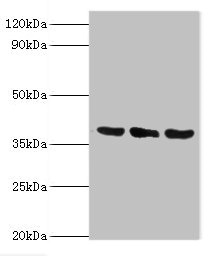 TMOD3 / Tropomodulin 3 Antibody - Western blot All lanes: TMOD3 antibody at 5µg/ml Lane 1: Jurkat whole cell lysate Lane 2: MCF-7 whole cell lysate Lane 3: Hela whole cell lysate Secondary Goat polyclonal to rabbit IgG at 1/10000 dilution Predicted band size: 40 kDa Observed band size: 40 kDa