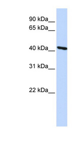 TMOD3 / Tropomodulin 3 Antibody - TMOD3 / Tropomodulin 3 antibody Western blot of HepG2 cell lysate.  This image was taken for the unconjugated form of this product. Other forms have not been tested.