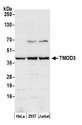 TMOD3 / Tropomodulin 3 Antibody - Detection of human TMOD3 by western blot. Samples: Whole cell lysate (50 µg) from HeLa, HEK293T, and Jurkat cells prepared using NETN lysis buffer. Antibody: Affinity purified rabbit anti-TMOD3 antibody used for WB at 0.4 µg/ml. Detection: Chemiluminescence with an exposure time of 30 seconds.