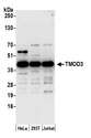 TMOD3 / Tropomodulin 3 Antibody - Detection of human TMOD3 by western blot. Samples: Whole cell lysate (15 µg) from HeLa, HEK293T, and Jurkat cells prepared using NETN lysis buffer. Antibody: Affinity purified rabbit anti-TMOD3 antibody used for WB at 0.1 µg/ml. Detection: Chemiluminescence with an exposure time of 30 seconds.
