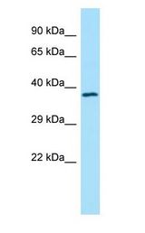 TMOD4 Antibody - TMOD4 / Tropomodulin 4 antibody Western Blot of Fetal Lung.  This image was taken for the unconjugated form of this product. Other forms have not been tested.