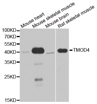 TMOD4 Antibody - Western blot analysis of extracts of various cell lines.