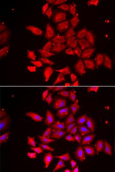 TMOD4 Antibody - Immunofluorescence analysis of U2OS cells.