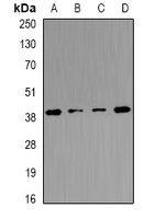TMOD4 Antibody - Western blot analysis of Tropomodulin-4 expression in mouse heart (A); mouse skeletal muscle (B); mouse brain (C); rat skeletal muscle (D) whole cell lysates.