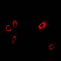 TMOD4 Antibody - Immunofluorescent analysis of Tropomodulin-4 staining in U2OS cells. Formalin-fixed cells were permeabilized with 0.1% Triton X-100 in TBS for 5-10 minutes and blocked with 3% BSA-PBS for 30 minutes at room temperature. Cells were probed with the primary antibody in 3% BSA-PBS and incubated overnight at 4 deg C in a humidified chamber. Cells were washed with PBST and incubated with a DyLight 594-conjugated secondary antibody (red) in PBS at room temperature in the dark.
