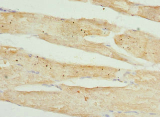 TMOD4 Antibody - Immunohistochemistry of paraffin-embedded human skeletal muscle tissue at dilution 1:100