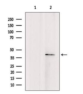 TMOD4 Antibody - Western blot analysis of extracts of rat brain tissue using TMOD4 antibody. Lane 1 was treated with the blocking peptide.