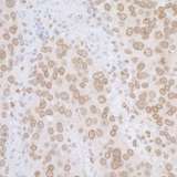 TMPO / TP / Thymopoietin Antibody - Detection of mouse LAP2 alpha beta gamma/TMPO by immunohistochemistry. Sample: FFPE section of mouse plasmacytoma. Antibody: Affinity purified rabbit anti-L AP2 alpha beta gamma/TMPO used at a dilution of 1:5,000 (0.2µg/ml). Detection: DAB