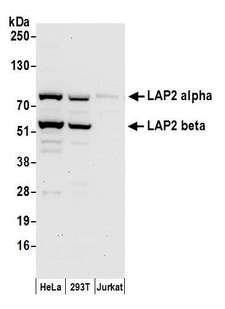 TMPO / TP / Thymopoietin Antibody - Detection of human LAP2 alpha and LAP2 beta by western blot. Samples: Whole cell lysate (50 µg) from HeLa, HEK293T, and Jurkat cells prepared using NETN lysis buffer. Antibody: Affinity purified rabbit anti-LAP2 alpha beta gamma antibody used for WB at 0.1 µg/ml. Detection: Chemiluminescence with an exposure time of 30 seconds.