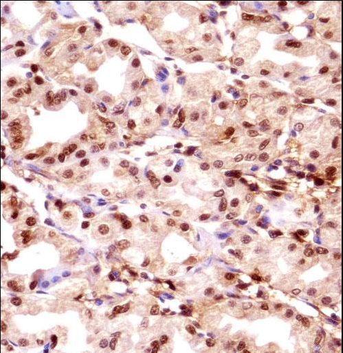 TMPO / TP / Thymopoietin Antibody - TMPO Antibody immunohistochemistry of formalin-fixed and paraffin-embedded human stomach tissue followed by peroxidase-conjugated secondary antibody and DAB staining.
