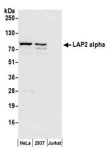 TMPO / TP / Thymopoietin Antibody - Detection of human LAP2 alpha by western blot. Samples: Whole cell lysate (50 µg) from HeLa, HEK293T, and Jurkat cells prepared using NETN lysis buffer. Antibody: Affinity purified rabbit anti-LAP2 alpha antibody used for WB at 0.1 µg/ml. Detection: Chemiluminescence with an exposure time of 30 seconds.