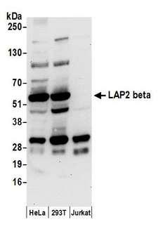 TMPO / TP / Thymopoietin Antibody - Detection of human LAP2 beta by western blot. Samples: Whole cell lysate (50 µg) from HeLa, HEK293T, and Jurkat cells prepared using NETN lysis buffer. Antibody: Affinity purified rabbit anti-LAP2 beta antibody used for WB at 0.4 µg/ml. Detection: Chemiluminescence with an exposure time of 30 seconds.