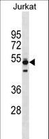 TMPO / TP / Thymopoietin Antibody - TMPO Antibody western blot of Jurkat cell line lysates (35 ug/lane). The TMPO antibody detected the TMPO protein (arrow).