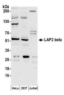 TMPO / TP / Thymopoietin Antibody - Detection of human LAP2 beta by western blot. Samples: Whole cell lysate (50 µg) from HeLa, HEK293T, and Jurkat cells prepared using NETN lysis buffer. Antibody: Affinity purified rabbit anti-LAP2 beta antibody used for WB at 0.4 µg/ml. Detection: Chemiluminescence with an exposure time of 30 seconds.