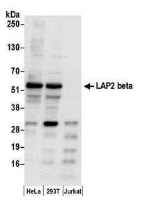 TMPO / TP / Thymopoietin Antibody - Detection of human LAP2 beta by western blot. Samples: Whole cell lysate (50 µg) from HeLa, HEK293T, and Jurkat cells prepared using NETN lysis buffer. Antibody: Affinity purified rabbit anti-LAP2 beta gamma antibody used for WB at 0.1 µg/ml. Detection: Chemiluminescence with an exposure time of 30 seconds.