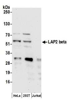 TMPO / TP / Thymopoietin Antibody - Detection of human LAP2 beta by western blot. Samples: Whole cell lysate (50 µg) from HeLa, HEK293T, and Jurkat cells prepared using NETN lysis buffer. Antibody: Affinity purified rabbit anti-LAP2 beta gamma antibody used for WB at 1 µg/ml. Detection: Chemiluminescence with an exposure time of 30 seconds.