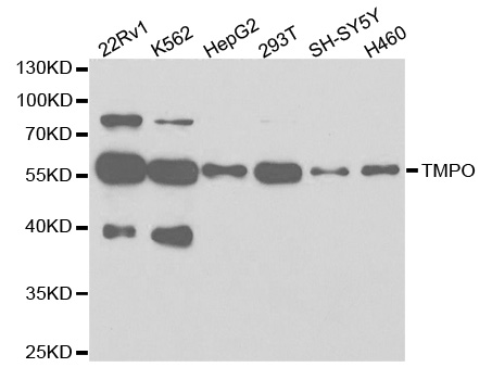TMPO / TP / Thymopoietin Antibody - Western blot analysis of extracts of various cell lines, using TMPO antibody.