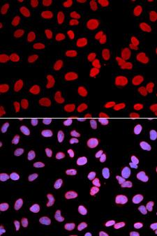 TMPO / TP / Thymopoietin Antibody - Immunofluorescence analysis of U2OS cell using TMPO antibody. Blue: DAPI for nuclear staining.