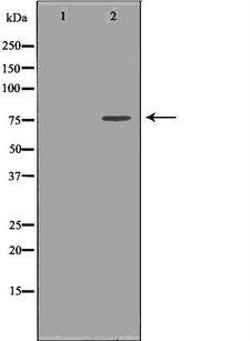 TMPO / TP / Thymopoietin Antibody - Western blot analysis of HepG2 whole cells lysates using TMPO antibody. The lane on the left is treated with the antigen-specific peptide.