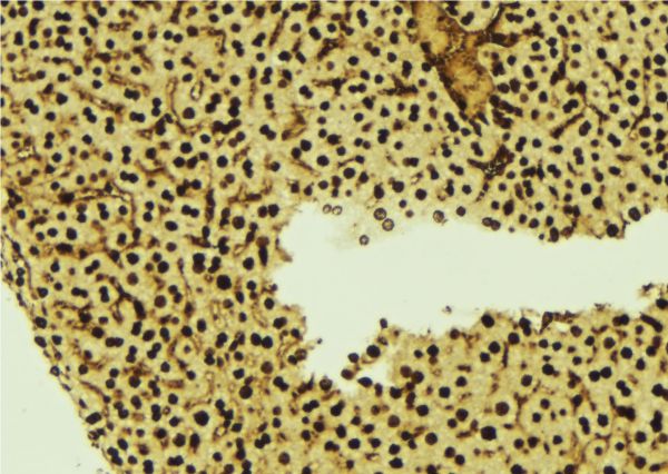 TMPO / TP / Thymopoietin Antibody - 1:100 staining mouse liver tissue by IHC-P. The sample was formaldehyde fixed and a heat mediated antigen retrieval step in citrate buffer was performed. The sample was then blocked and incubated with the antibody for 1.5 hours at 22°C. An HRP conjugated goat anti-rabbit antibody was used as the secondary.