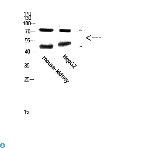 TMPO / TP / Thymopoietin Antibody - Western Blot (WB) analysis of Mouse Kidney, HepG2 cells using Antibody diluted at 1:800.