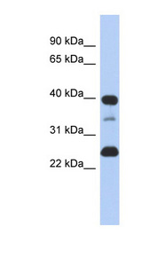 TMPO / TP / Thymopoietin Antibody - TMPO / Thymopoietin antibody Western blot of SH-SYSY lysate. This image was taken for the unconjugated form of this product. Other forms have not been tested.