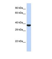 TMPPE Antibody - Western blot of Human 721_B. TMPPE antibody dilution 1.0 ug/ml.  This image was taken for the unconjugated form of this product. Other forms have not been tested.