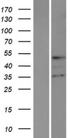 TMPPE Protein - Western validation with an anti-DDK antibody * L: Control HEK293 lysate R: Over-expression lysate